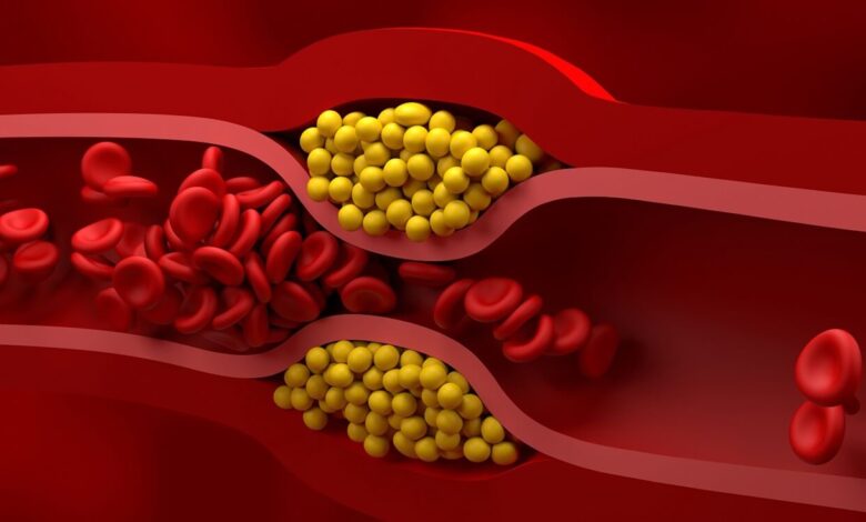 LDL Kolesterol Nedir? 1 LDL Kolesterol Nedir?
