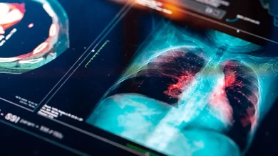 Ege Üniversitesinde borik asidin akciğer kanseri tedavisine yönelik etkisi araştırılacak.