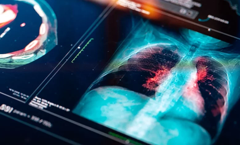 Ege Üniversitesinde borik asidin akciğer kanseri tedavisine yönelik etkisi araştırılacak.