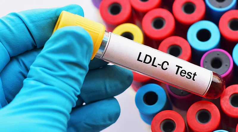 LDL kolesterol yüksekliğinin kalp ve damar hastalıklarına etkisi, LDL Kolestrol seviyesi ve LDl Kolestrol ile ilgili haberler Hipokrat Derginizde.