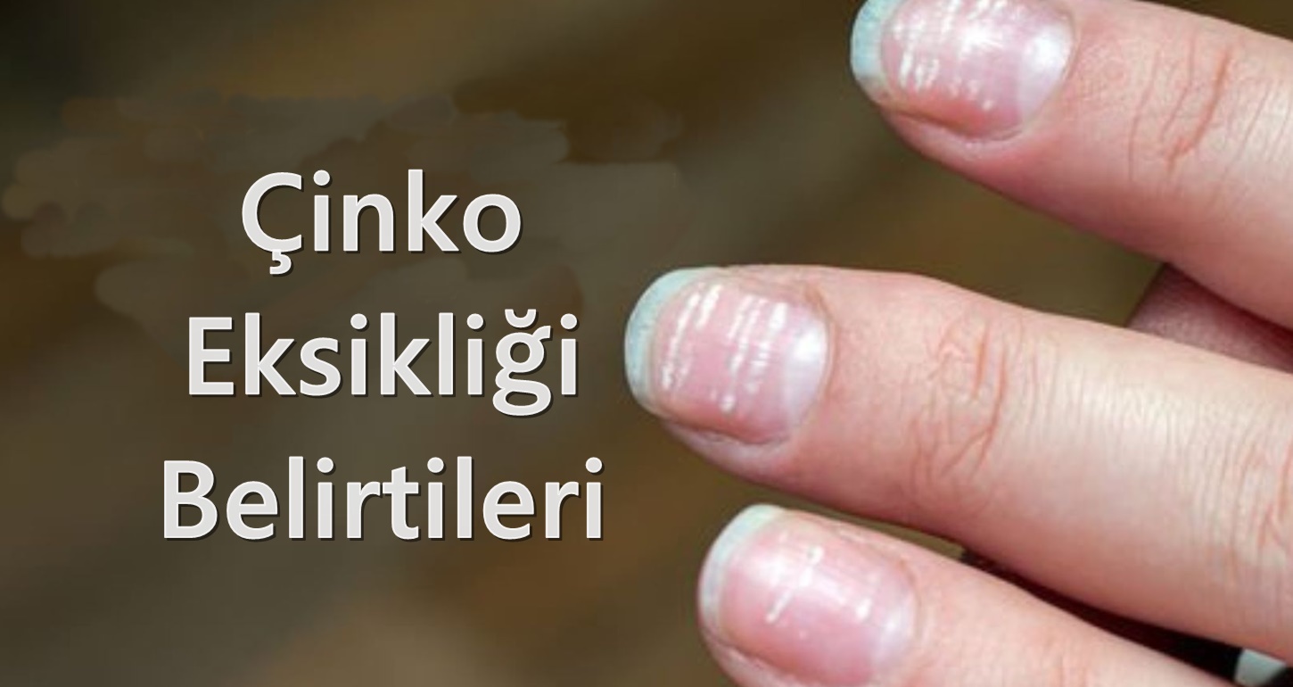 Çinko Eksikliği Belirtileri