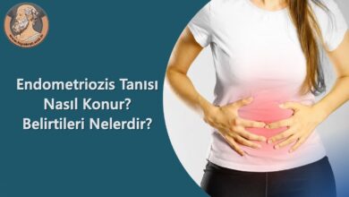 Endometriozis Belirtileri Nelerdir? Tanısı Nasıl Konur?