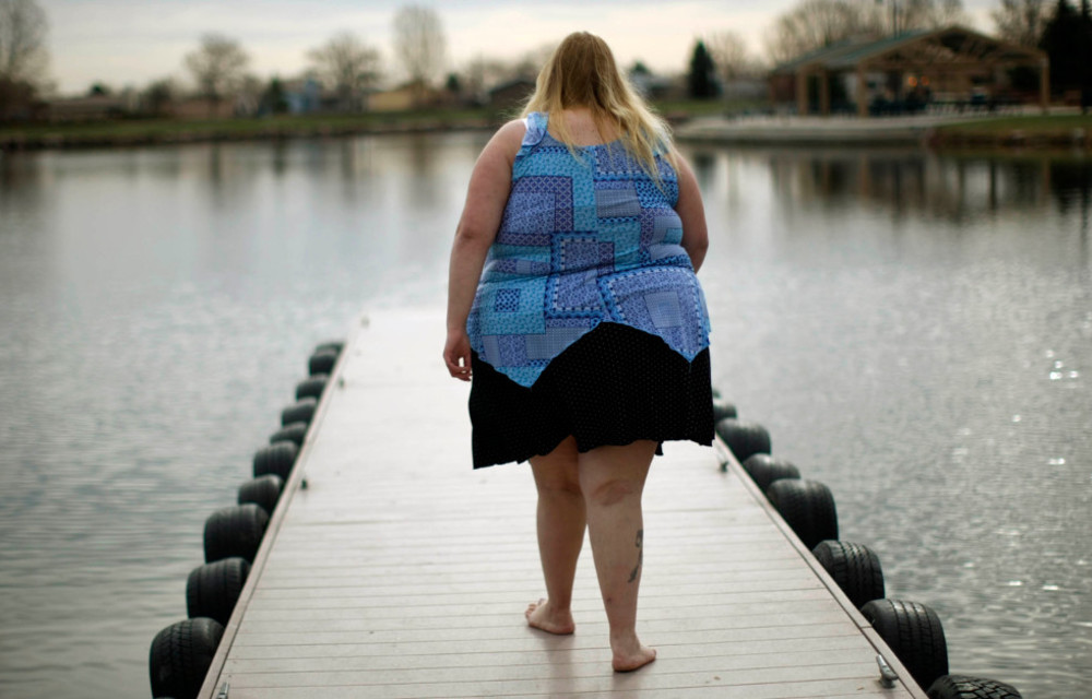 Çağımızın en büyük sağlık sorunlarının başında obezite geliyor. Obezite 7’den 77’ye kadar pek çok insanı olumsuz etkiliyor.