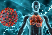 Post Covid Nedir? Belirtileri ve tedavisi...