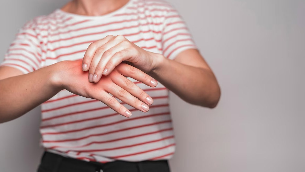 Romatoid artrit sadece eklemleri değil cildi de etkileyebilir. Hastalık ilerledikçe veya tedavi sürecinde farklı cilt döküntüleri ortaya çıkabilir.