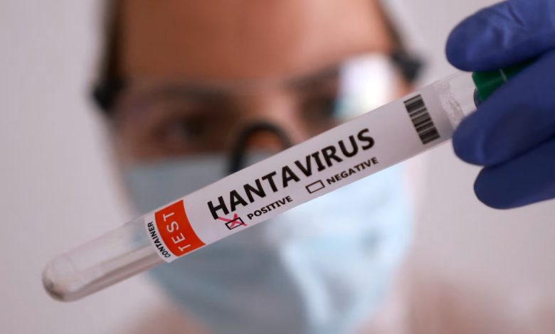 hantavirus ne nasil bulasir turkiyede var mi