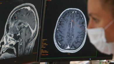 COVID-19’un etkilerinin belirtiler sona erdikten sonra da beyinde devam edebileceğine işaret eden yeni bir araştırma yayımlandı.